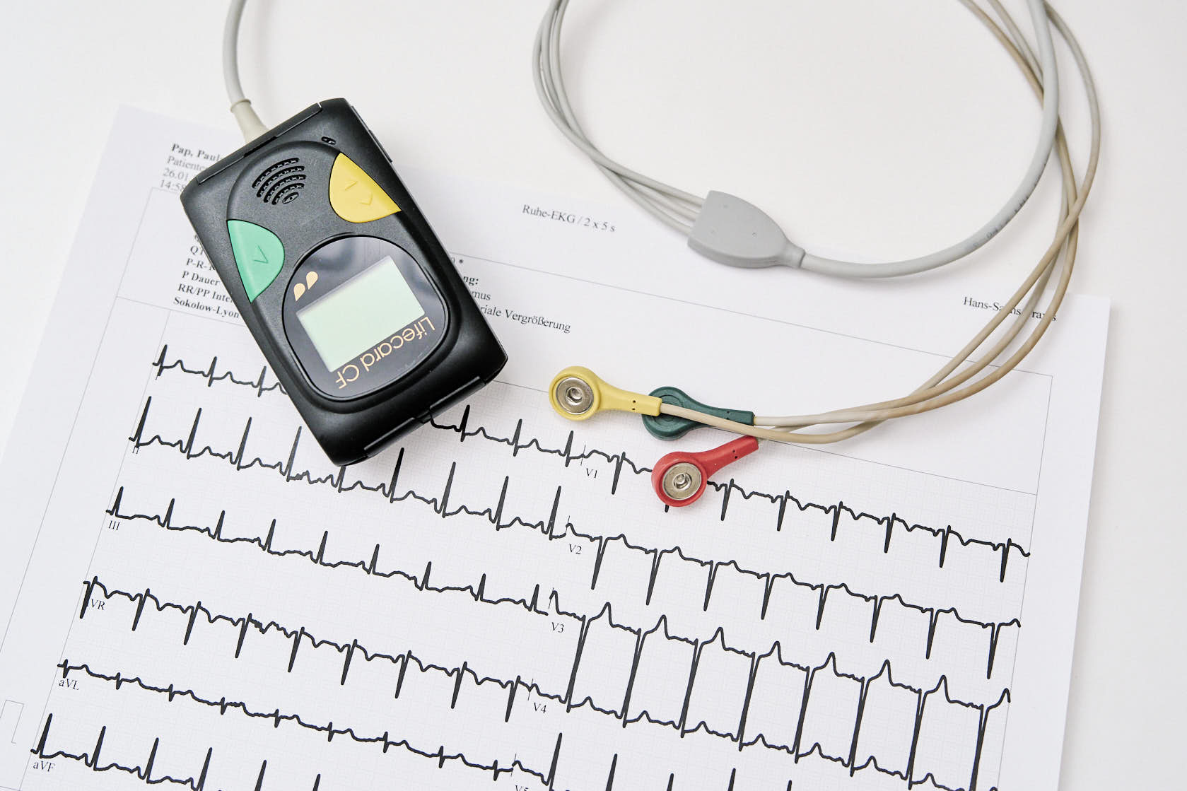 Langzeit-EKG – tragbares Aufzeichnungsgerät für die 24-Stunden-EKG-Messung